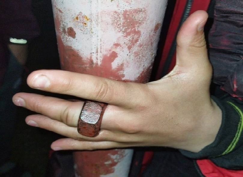 Во Владимире спасатели помогли 11-летнему мальчику вытащить палец из гайки